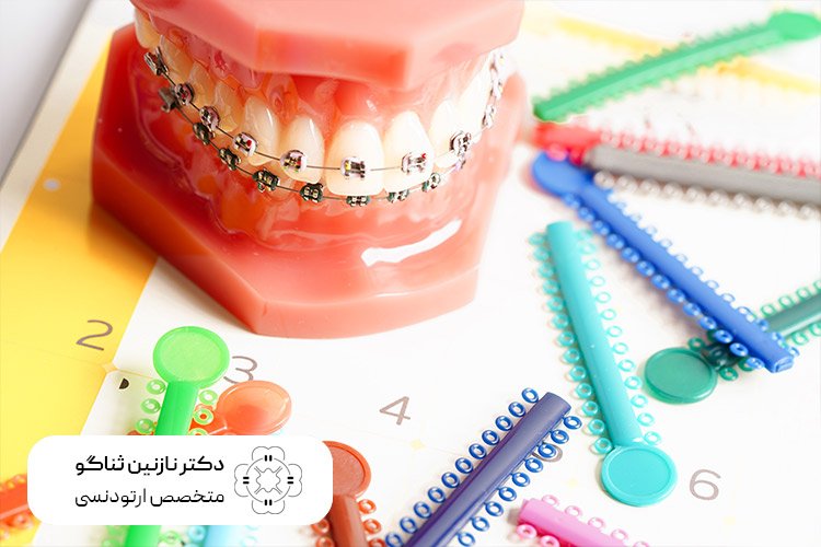 اجزای ارتودنسی ثابت دندان