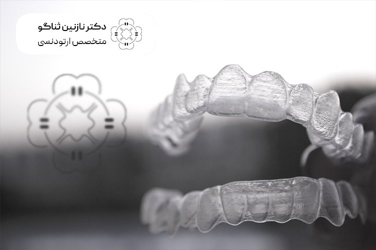 مزایای استفاده از خدمات ارتودنسی نامرئی تیم دندانپزشکی دکتر ثناگو