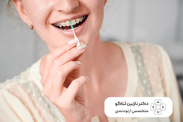 آشنایی با اهمیت بهداشت دهان و دندان در زمان ارتودنسی