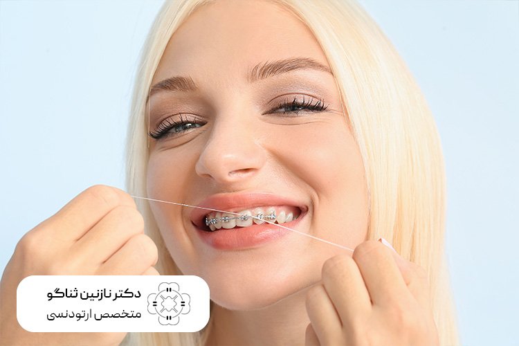 ابزارهای ارتودنسی برای رعایت بهداشت دهان و دندان در زمان ارتودنسی