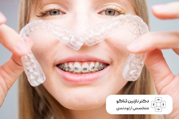 نکات مهم در مورد رعایت بهداشت دهان و دندان در زمان ارتودنسی