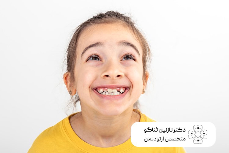 کدام کودکان به ارتودنسی دندان نیاز دارند؟