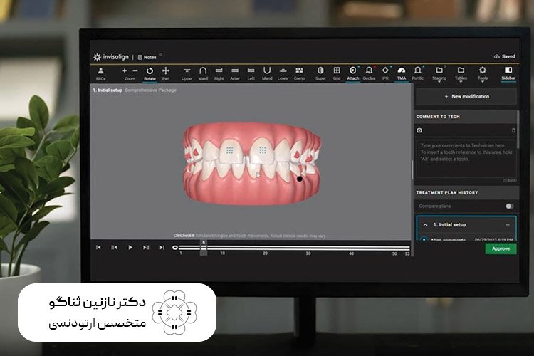 اسکنر داخل دهانی ۳بعدی توسط بهترین متخصص ارتودنسی تهران