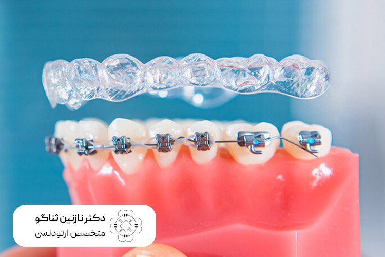 متد درمان بهترین متخصص ارتودنسی در تهران