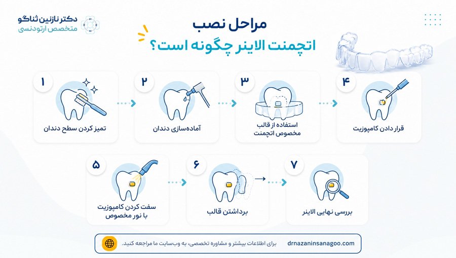 مراحل نصب اتچمنت الاینر چگونه است؟