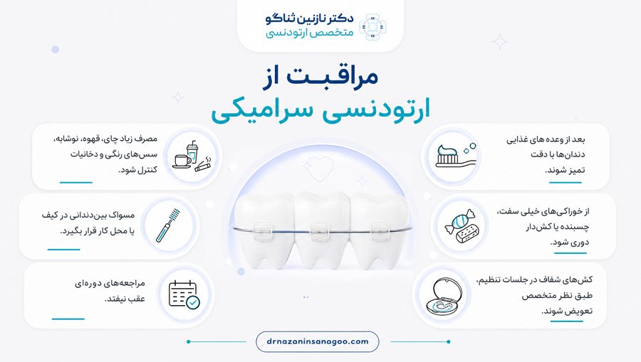 مراقبت از ارتودنسی سرامیکی