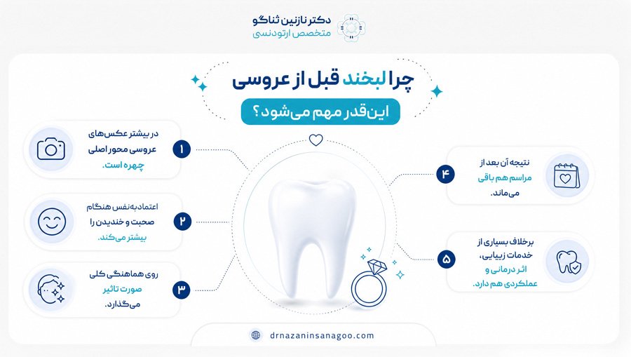 چرا لبخند قبل از عروسی این‌قدر مهم می‌شود؟