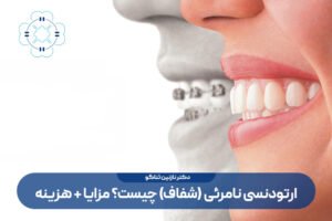ارتودنسی نامرئی یا ارتودنسی شفاف