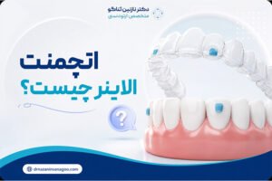 اتچمنت الاینر چیست