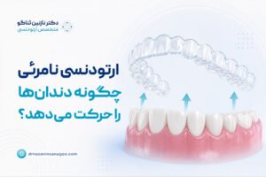 ارتودنسی نامرئی چگونه دندان‌ها را حرکت می‌دهد