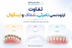 تفاوت ارتودنسی نامرئی، شفاف و لینگوال