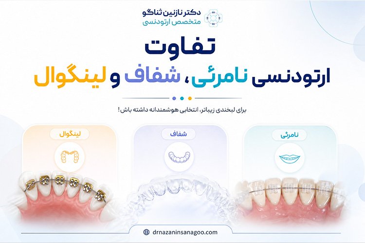 تفاوت ارتودنسی نامرئی، شفاف و لینگوال
