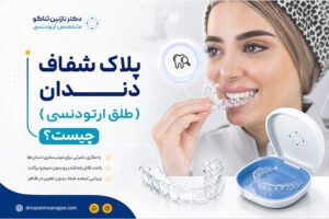 پلاک شفاف دندان (طلق ارتودنسی) چیست
