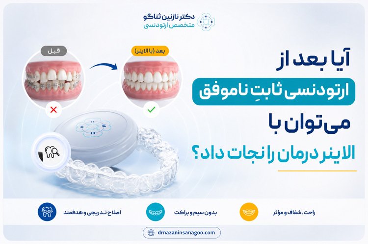 آیا بعد از ارتودنسی ثابتِ ناموفق می‌توان با الاینر درمان را نجات داد؟
