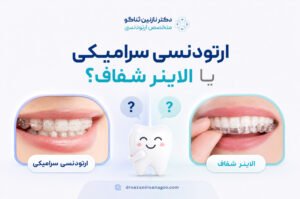 ارتودنسی سرامیکی یا الاینر شفاف