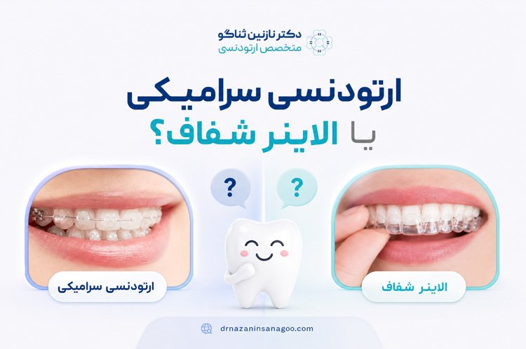 ارتودنسی سرامیکی یا الاینر شفاف