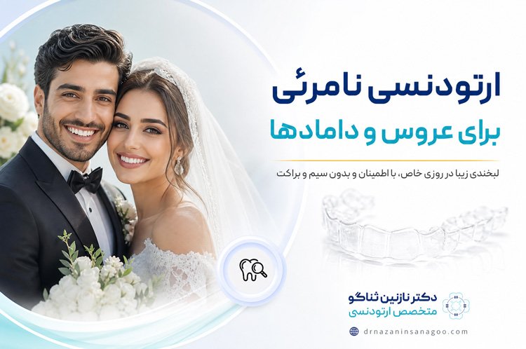 ارتودنسی نامرئی برای عروس و دامادها
