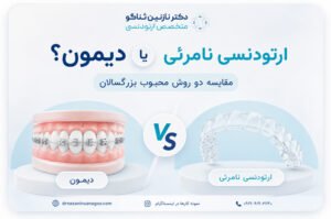 ارتودنسی نامرئی یا دیمون؟