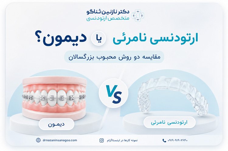 ارتودنسی نامرئی یا دیمون؟