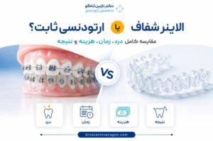 الاینر شفاف یا ارتودنسی ثابت