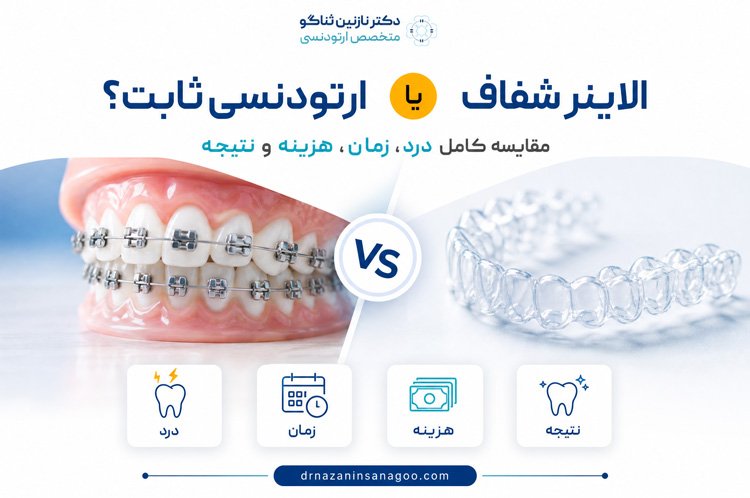 الاینر شفاف یا ارتودنسی ثابت