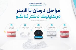 مراحل درمان با الاینر در کلینیک دکتر ثناگو