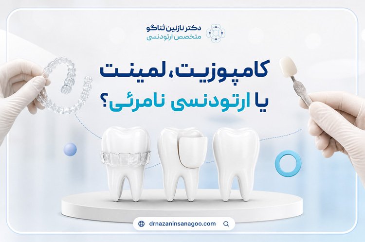کامپوزیت، لمینت یا ارتودنسی نامرئی