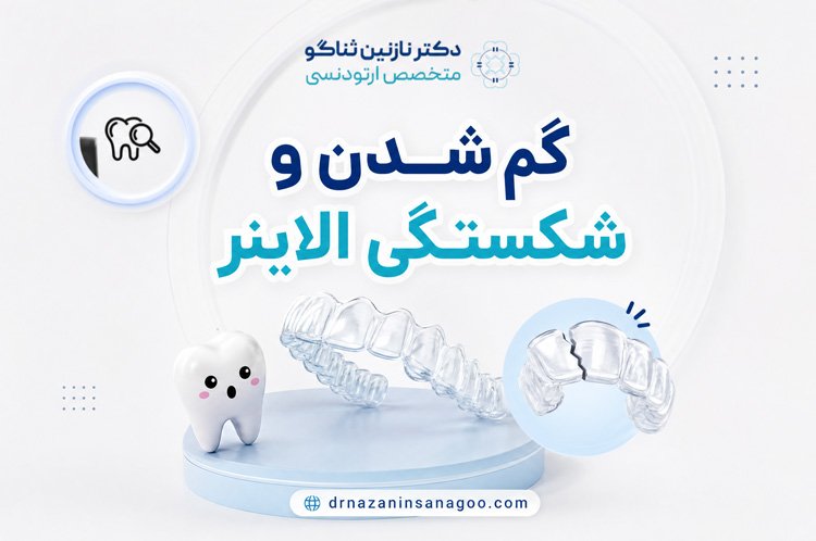 گم شدن و شکستگی الاینر